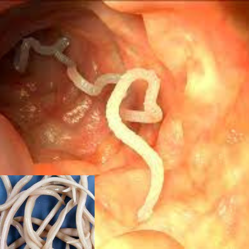 Imagem do organismo humano infectado com parasita